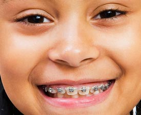 children-orthodontics