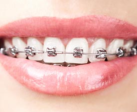 Children’s & Adult Orthodontics